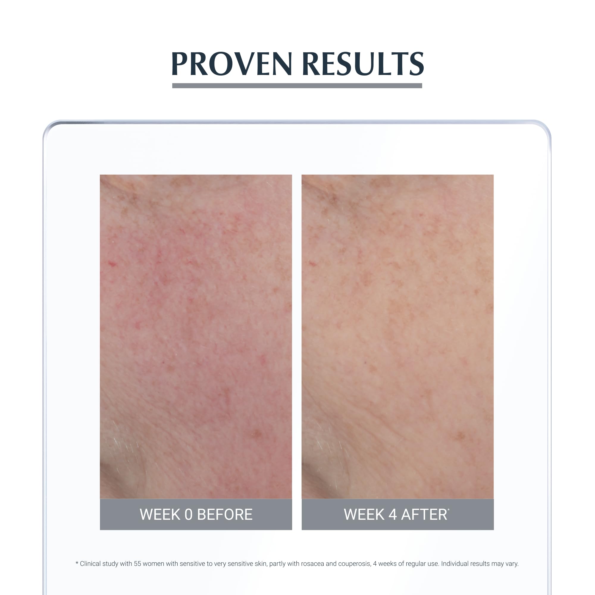 Eucerin AntiRedness Concealing Day Cream SPF 25 - Instantly Soothes & Conceals Redness | 50 ml 7