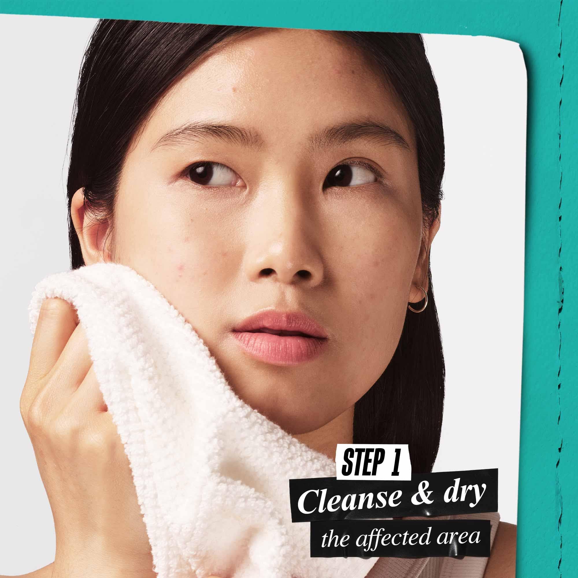 Kiehl's Overnight Blemish Patch - Hydrocolloid Spot Treatment for Blemishes | Unisex Adult 4