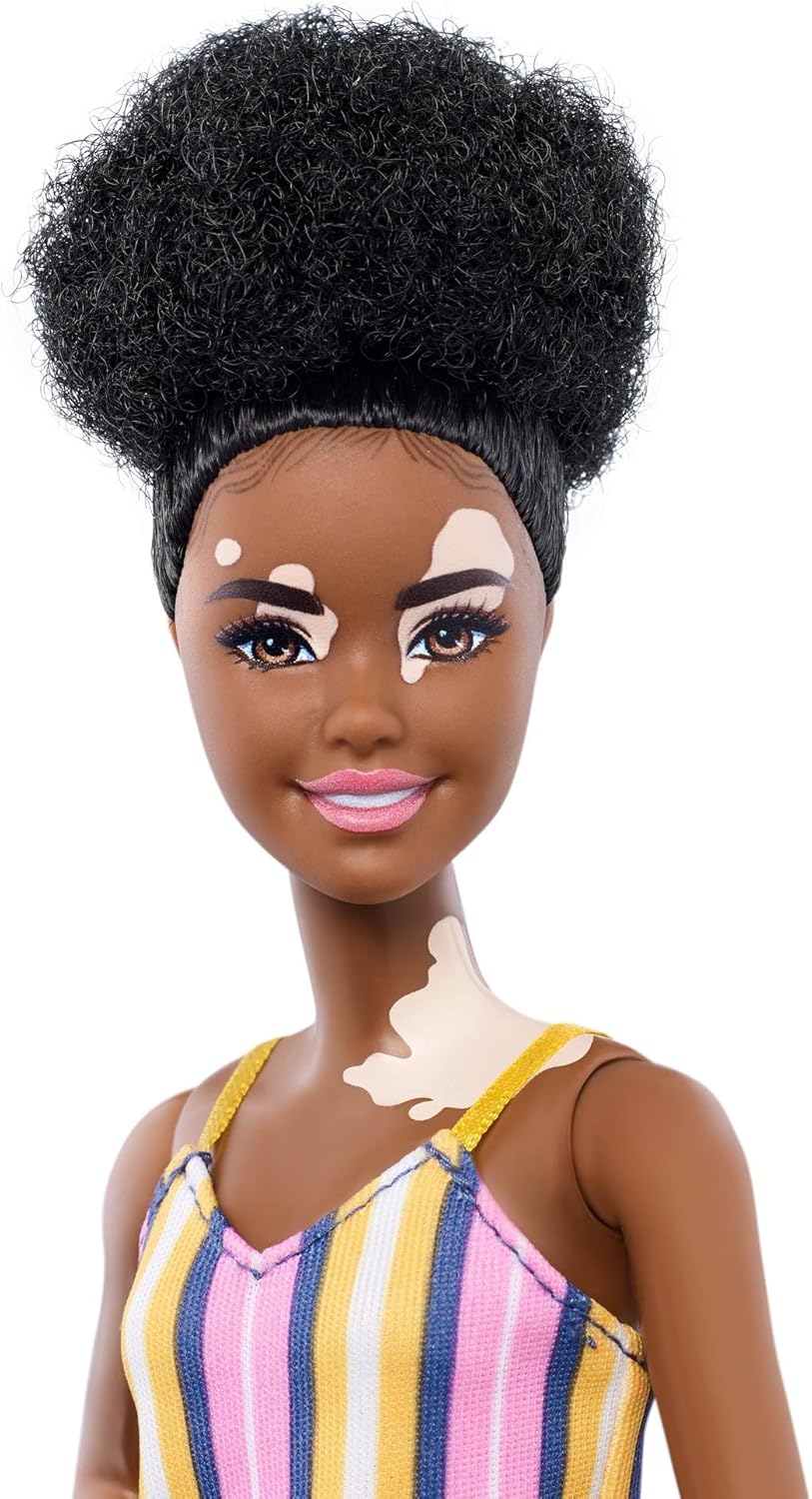 Barbie Fashionistas Vitiligo Doll (Model GYG08) - Inclusive Play & Imaginative Storytelling for Ages 3+