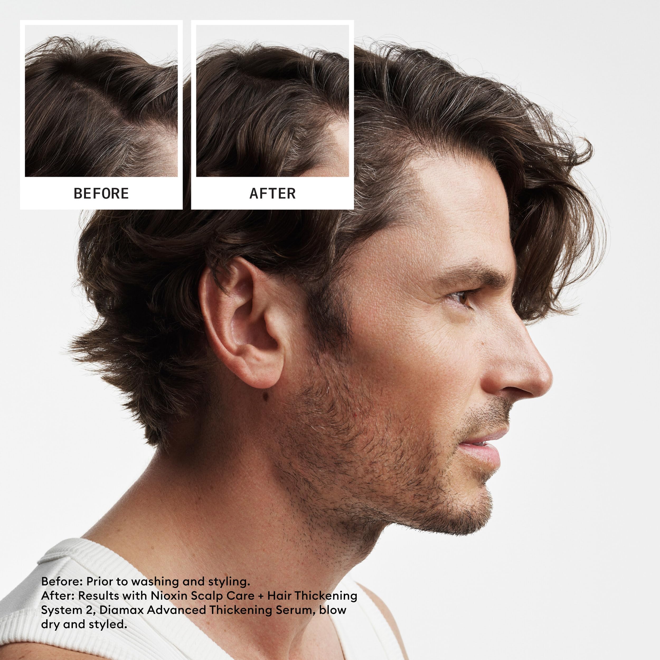 NIOXIN System 2 Kit - Hair Thickening System for Natural Hair with Progressed Thinning | Shampoo, Conditioner & Scalp Treatment (150ml+150ml+40ml) 5